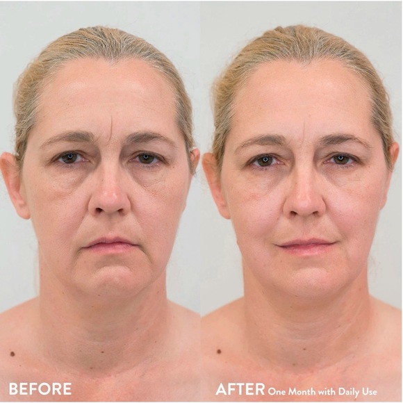 COSMEDIX Purple Facial And Body Massage Roller - Picture 4 of 4